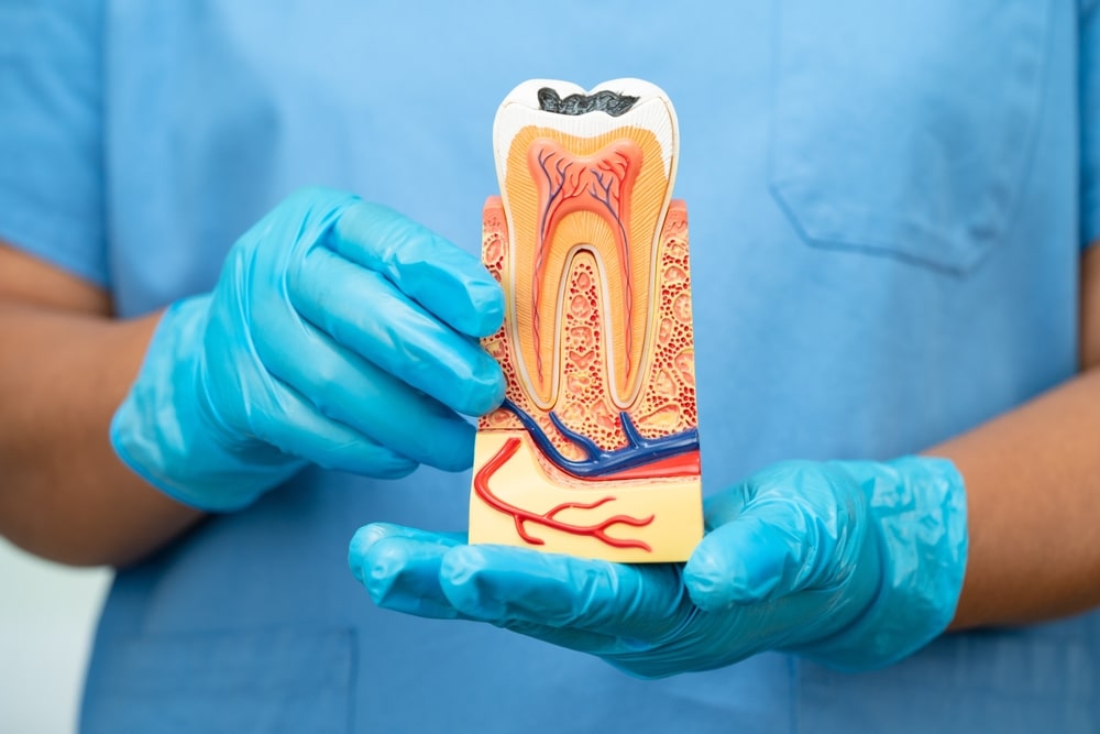 Root canal treatment removes infection from inside the tooth, relieves discomfort, and helps you save your natural tooth with a lasting restoration.